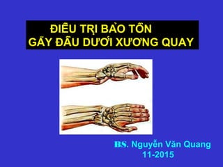 ĐIỀU TRỊ BẢO TỒN
GÃY ĐẦU DƯỚI XƯƠNG QUAY
BS. Nguyễn Văn Quang
11-2015
 
