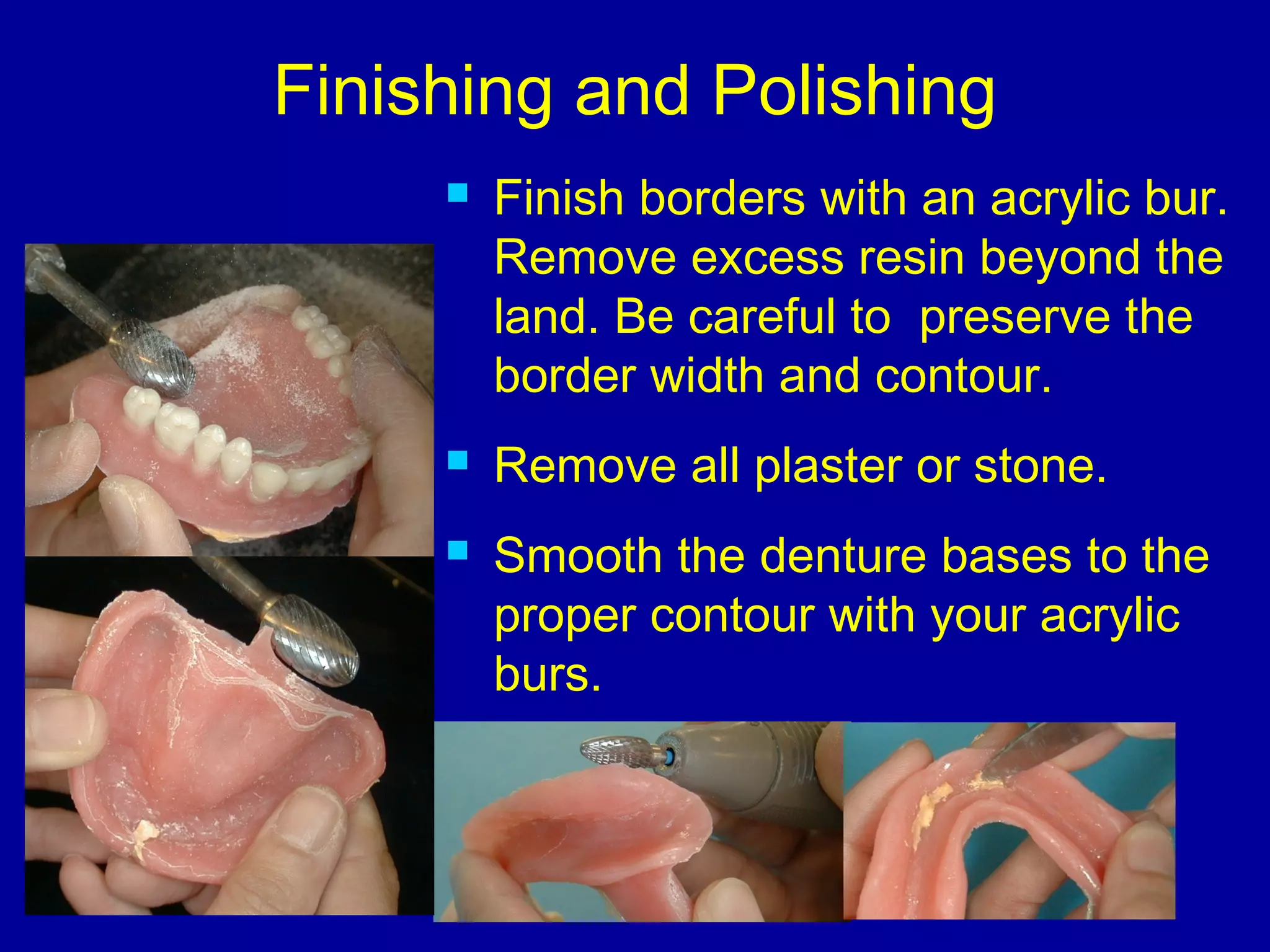 Finishing and Polishing
 Finish borders with an acrylic bur.
Remove excess resin beyond the
land. Be careful to preserve the
border width and contour.
 Remove all plaster or stone.
 Smooth the denture bases to the
proper contour with your acrylic
burs.
 