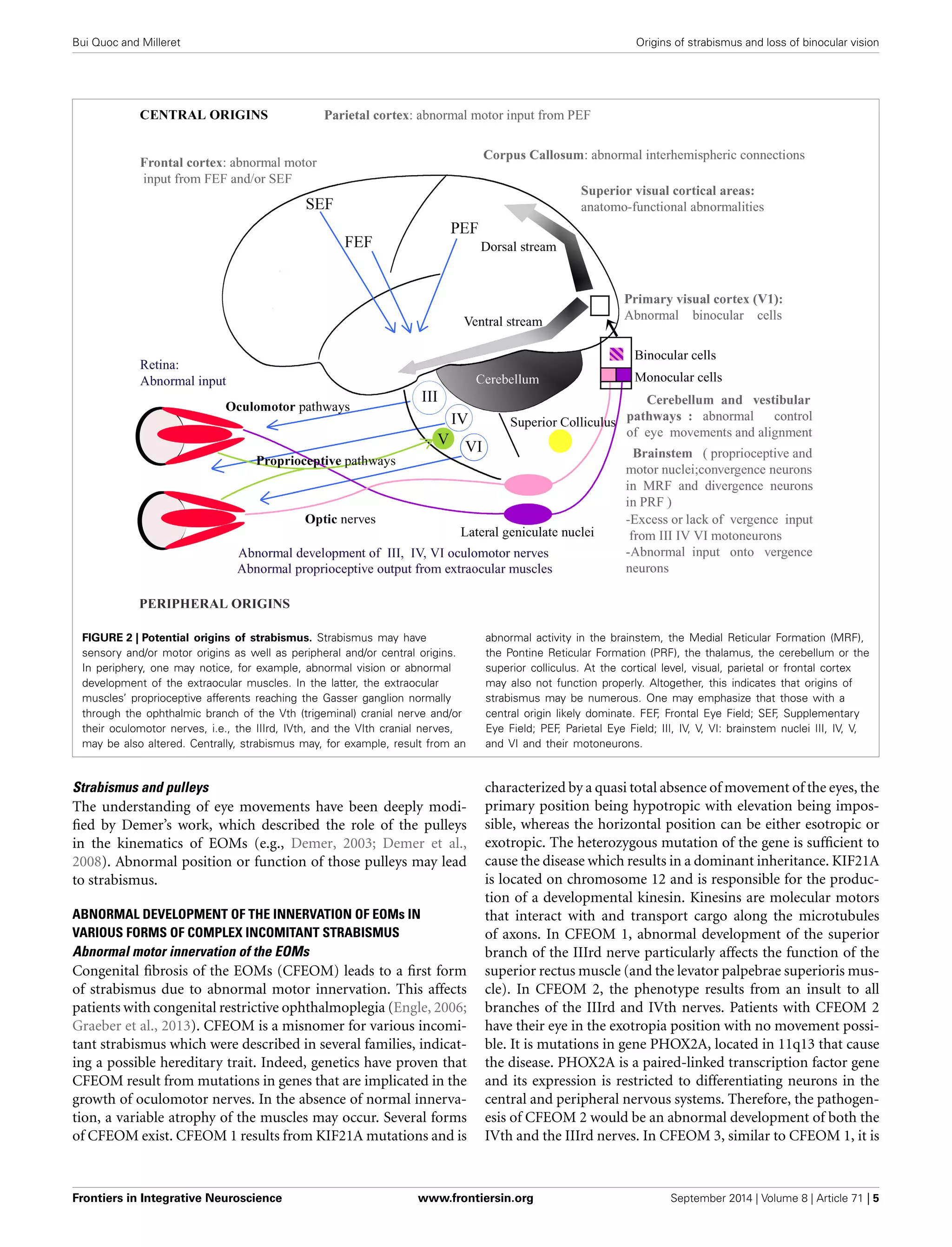 Bui Quoc and Milleret Origins of strabismus and loss of binocular vision
FIGURE 2 | Potential origins of strabismus. Strabismus may have
sensory and/or motor origins as well as peripheral and/or central origins.
In periphery, one may notice, for example, abnormal vision or abnormal
development of the extraocular muscles. In the latter, the extraocular
muscles’ proprioceptive afferents reaching the Gasser ganglion normally
through the ophthalmic branch of the Vth (trigeminal) cranial nerve and/or
their oculomotor nerves, i.e., the IIIrd, IVth, and the VIth cranial nerves,
may be also altered. Centrally, strabismus may, for example, result from an
abnormal activity in the brainstem, the Medial Reticular Formation (MRF),
the Pontine Reticular Formation (PRF), the thalamus, the cerebellum or the
superior colliculus. At the cortical level, visual, parietal or frontal cortex
may also not function properly. Altogether, this indicates that origins of
strabismus may be numerous. One may emphasize that those with a
central origin likely dominate. FEF, Frontal Eye Field; SEF, Supplementary
Eye Field; PEF, Parietal Eye Field; III, IV, V, VI: brainstem nuclei III, IV, V,
and VI and their motoneurons.
Strabismus and pulleys
The understanding of eye movements have been deeply modi-
ﬁed by Demer’s work, which described the role of the pulleys
in the kinematics of EOMs (e.g., Demer, 2003; Demer et al.,
2008). Abnormal position or function of those pulleys may lead
to strabismus.
ABNORMAL DEVELOPMENT OF THE INNERVATION OF EOMs IN
VARIOUS FORMS OF COMPLEX INCOMITANT STRABISMUS
Abnormal motor innervation of the EOMs
Congenital ﬁbrosis of the EOMs (CFEOM) leads to a ﬁrst form
of strabismus due to abnormal motor innervation. This affects
patients with congenital restrictive ophthalmoplegia (Engle, 2006;
Graeber et al., 2013). CFEOM is a misnomer for various incomi-
tant strabismus which were described in several families, indicat-
ing a possible hereditary trait. Indeed, genetics have proven that
CFEOM result from mutations in genes that are implicated in the
growth of oculomotor nerves. In the absence of normal innerva-
tion, a variable atrophy of the muscles may occur. Several forms
of CFEOM exist. CFEOM 1 results from KIF21A mutations and is
characterized by a quasi total absence of movement of the eyes, the
primary position being hypotropic with elevation being impos-
sible, whereas the horizontal position can be either esotropic or
exotropic. The heterozygous mutation of the gene is sufﬁcient to
cause the disease which results in a dominant inheritance. KIF21A
is located on chromosome 12 and is responsible for the produc-
tion of a developmental kinesin. Kinesins are molecular motors
that interact with and transport cargo along the microtubules
of axons. In CFEOM 1, abnormal development of the superior
branch of the IIIrd nerve particularly affects the function of the
superior rectus muscle (and the levator palpebrae superioris mus-
cle). In CFEOM 2, the phenotype results from an insult to all
branches of the IIIrd and IVth nerves. Patients with CFEOM 2
have their eye in the exotropia position with no movement possi-
ble. It is mutations in gene PHOX2A, located in 11q13 that cause
the disease. PHOX2A is a paired-linked transcription factor gene
and its expression is restricted to differentiating neurons in the
central and peripheral nervous systems. Therefore, the pathogen-
esis of CFEOM 2 would be an abnormal development of both the
IVth and the IIIrd nerves. In CFEOM 3, similar to CFEOM 1, it is
Frontiers in Integrative Neuroscience www.frontiersin.org September 2014 | Volume 8 | Article 71 | 5
 