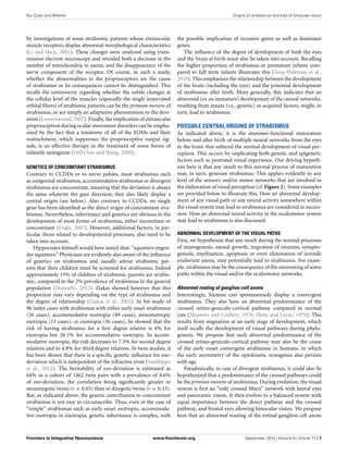 Origins of strabismus and loss of binocular vision | PDF