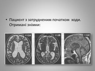 • Пациєнт з затрудненим початком ходи.
Отримані знімки:
 