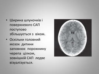• Ширина шлуночків і
поверхневого САП
поступово
збільшується з віком.
• Оскільки головний
мозок дитини
заповнює порожнину
черепа цілком,
зовнішній САП ледве
візуалізується.
 