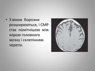 • З віком борозни
розширюються, і СМР
стає помітнішою між
корою головного
мозку і склепінням
черепа.
 