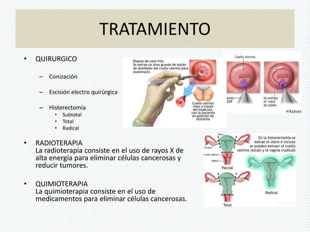 cancer cervicouterino en enfermeria