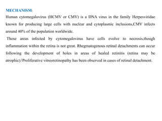MECHANISM:
Human cytomegalovirus (HCMV or CMV) is a DNA virus in the family Herpesviridae
known for producing large cells with nuclear and cytoplasmic inclusions,CMV infects
around 40% of the population worldwide.
Those areas infected by cytomegalovirus have cells evolve to necrosis,though
inflammation within the retina is not great. Rhegmatogenous retinal detachments can occur
following the development of holes in areas of healed retinitis (retina may be
atrophic).[Proliferative vitreoretinopathy has been observed in cases of retinal detachment.
 