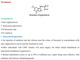 Treatment:
Structure of ganciclovir
1.Ganciclovir:
oral valganciclovir,
 intravenous ganciclovir,
IV foscarnet, and
IV cidofovir
 Intravitreal injections:
 An injection of medicine into the vitreous near the retina, of foscarnet in concomitance with
oral valganciclovir can be used for treatment as well.
Often individuals with CMV retinitis will need surgery for either retinal detachment or
intravitreal instillation of ganciclovir.
 Retinal detachment occurs in up to 29% of affected eyes, repair being most effective with
endolaser and silicone oilendotamponade.
 
