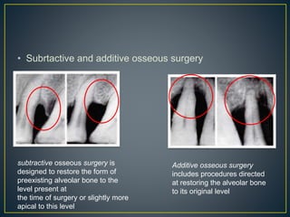 • Subrtactive and additive osseous surgery
Additive osseous surgery
includes procedures directed
at restoring the alveolar bone
to its original level
subtractive osseous surgery is
designed to restore the form of
preexisting alveolar bone to the
level present at
the time of surgery or slightly more
apical to this level
 