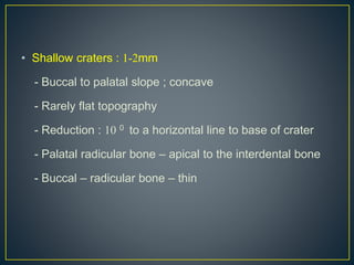 • Shallow craters : 1-2mm
- Buccal to palatal slope ; concave
- Rarely flat topography
- Reduction : 10 0 to a horizontal line to base of crater
- Palatal radicular bone – apical to the interdental bone
- Buccal – radicular bone – thin
 