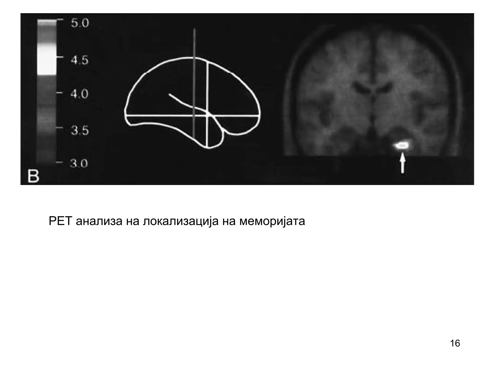 16
PET анализа на локализација на меморијата
 