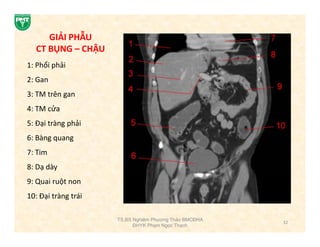 4. Ứng Dụng Của CT Ổ Bụng Trong Chẩn Đoán Bệnh