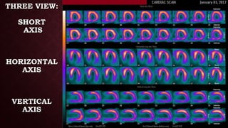 THREE VIEW:
SHORT
AXIS
HORIZONTAL
AXIS
VERTICAL
AXIS
 
