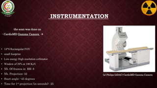 INSTRUMENTATION
the scan was done on
- CardioMD Gamma Camera 
• 14*8 Rectangular FOV
• small footprint
• Low energy High resolution collimator.
• Window of 20% at 140 KeV.
• Nb. Of frames in RR: 8
• Nb. Projection: 32
• Start angle: -45 degrees
• Time for 1st projection (in seconds): 25
(a) Philips (ADAC) CardioMD Gamma Camera
 
