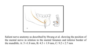 Salient nerve anatomy as described by Hwang et al. showing the position of
the mental nerve in relation to the mental foramen and inferior border of
the mandible. A: 5 ±1.8 mm, B: 4.5 ± 1.9 mm, C: 9.2 ± 2.7 mm
 