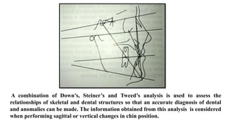 A combination of Down’s, Steiner’s and Tweed’s analysis is used to assess the
relationships of skeletal and dental structures so that an accurate diagnosis of dental
and anomalies can be made. The information obtained from this analysis is considered
when performing sagittal or vertical changes in chin position.
 