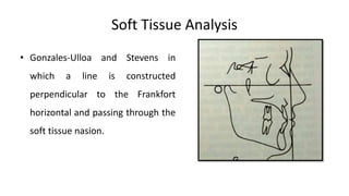 Soft Tissue Analysis
• Gonzales-Ulloa and Stevens in
which a line is constructed
perpendicular to the Frankfort
horizontal and passing through the
soft tissue nasion.
 