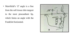 • Merrifield’s ‘Z’ angle is a line
from the soft tissue chin tangent
to the most procumbent lip,
which forms an angle with the
Frankfort horizontal.
 