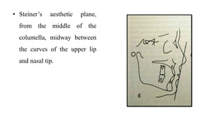 • Steiner’s aesthetic plane,
from the middle of the
columella, midway between
the curves of the upper lip
and nasal tip.
 