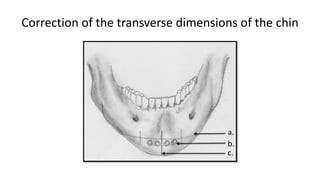 Correction of the transverse dimensions of the chin
 