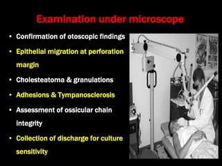 Examination under microscope
• Confirmation of otoscopic findings
• Epithelial migration at perforation
margin
• Cholesteatoma & granulations
• Adhesions & Tympanosclerosis
• Assessment of ossicular chain
integrity
• Collection of discharge for culture
sensitivity
 