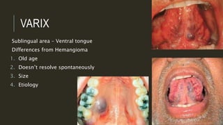 Oral Pigmentations