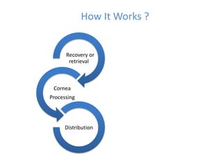 Recovery or
retrieval
Cornea
Processing
Distribution
How It Works ?
 