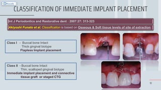 10
CLASSIFICATION OF IMMEDIATE IMPLANT PLACEMENT
Int J Periodontics and Restorative dent : 2007:27: 313-323
Akiyoshi Funato et al. Classification is based on Osseous & Soft tissue levels of site of extraction.
Class I - Buccal bone Intact
Thick gingival biotype
Flapless Implant placement
Class II - Buccal bone Intact
Thin, scalloped gingival biotype
Immediate implant placement and connective
tissue graft or staged CTG
 