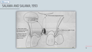 19
SALAMA AND SALAMA; 1993
 