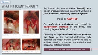 2
0
WHAT IF IT DOESN’T HAPPEN ?? Any implant that can be moved laterally with
finger pressure following placement will have a
poor chance of achieving osseointegration
should be ABORTED
An undersized osteotomy may result in
compression necrosis of the bone, thus
causing implant failure to occur.
Choosing an implant with restorative platform
too large for the planned restoration, only
because the larger implant diameter is able to
achieve stability  concern for esthetics and
horizontal defect dimension
Buser, Martin et al. 2004; Araujo, Wennstrom et al. 2006
 
