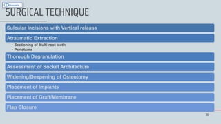 36
SURGICAL TECHNIQUE
Sulcular Incisions with Vertical release
Atraumatic Extraction
• Sectioning of Multi-root teeth
• Periotome
Thorough Degranulation
Assessment of Socket Architecture
Widening/Deepening of Osteotomy
Placement of Implants
Placement of Graft/Membrane
Flap Closure
 