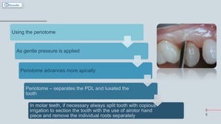 3
8
Using the periotome
As gentle pressure is applied
Periotome advances more apically
Periotome – separates the PDL and luxated the
tooth
In molar teeth, if necessary always split tooth with copious
irrigation to section the tooth with the use of airotor hand
piece and remove the individual roots separately
 
