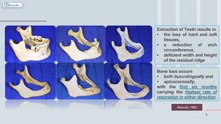 4
Extraction of Teeth results in
• the loss of hard and soft
tissues,
• a reduction of arch
circumference,
• deficient width and height
of the residual ridge
Bone loss occurs
• both buccolingually and
• apicocoronally,
with the first six months
carrying the highest rate of
resorption in either direction.
Atwood, 1983
 