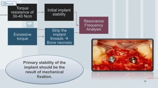 45
Torque
resistance of
30-40 Ncm
Initial implant
stability
Resonance
Frequency
Analysis
Excessive
torque
Strip the
implant
threads 
Bone necrosis
Primary stability of the
implant should be the
result of mechanical
fixation.
 