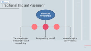 Varying degrees
of resorption and
remodeling
Long waiting period several surgical
interventions
6
Traditional Implant Placement
NOT VERY
ATTRACTIVE
 