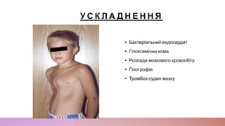 У С К Л А Д Н Е Н Н Я
• Бактеріальний ендокардит
• Гіпоксемічна кома
• Розлади мозкового кровообігу
• Гіпотрофія
• Тромбоз судин мозку
 