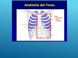 Cupola
Horizontal fissure
Costomediastinal
recess
Oblique fissure
AREA
PELIGROS
A DE
BARNES
Cardiac notch
Oblique fissure
Costodiaphragmatic
recess
 