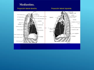 r1çhtbrrchl
r1ghtpFrehtcnerve
0U%FlOF VBñ6 taVg
l0cephz)1c mei*
r1qht a(I•lIMc0ver4dhyserJcardimitrlc)e
icardíw
rdun
thorac1Cduct
syfipathet1c trufik
)eft phrenic nerva
esophagus
lett recurrent laryngeal
left pulmonary artery
Iefi broschi
descen4i ng «orta
greater sptanchnl c
daphragm
 