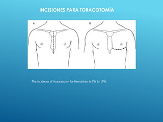 INCISIONES PARA TORACOTOMÍA
The incidence of thoracotomy for Hemotórax is 5% to 15%
 