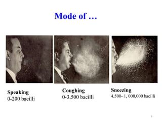 Mode of …
9
Speaking
0-200 bacilli
Coughing
0-3,500 bacilli
Sneezing
4.500- 1, 000,000 bacilli
 