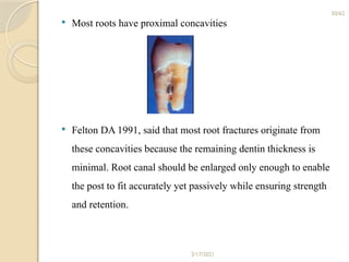 PROSTHODONTIC MANAGEMENT OF ENDODONTICALLY TREATED TEETH | PPTX