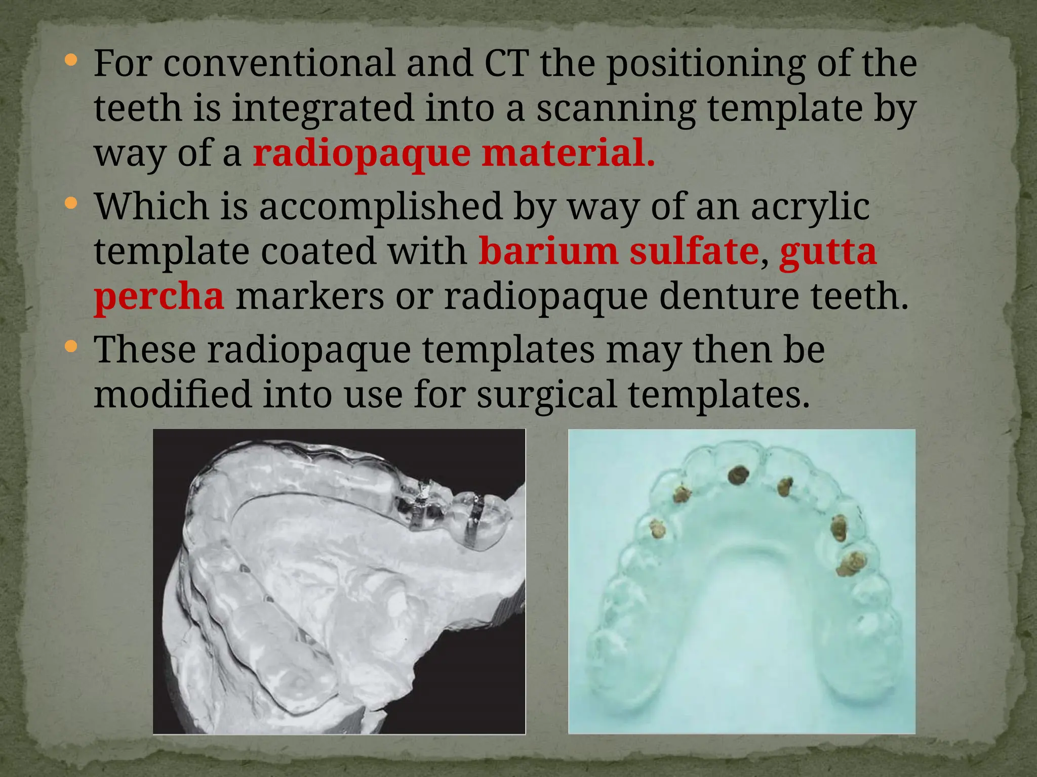 13.Radiographic imaging in implant dentistry.pptx