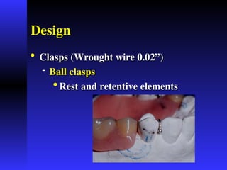 Interiem Rpd nature and usage of Interim Removable Partial Dentures | PPT