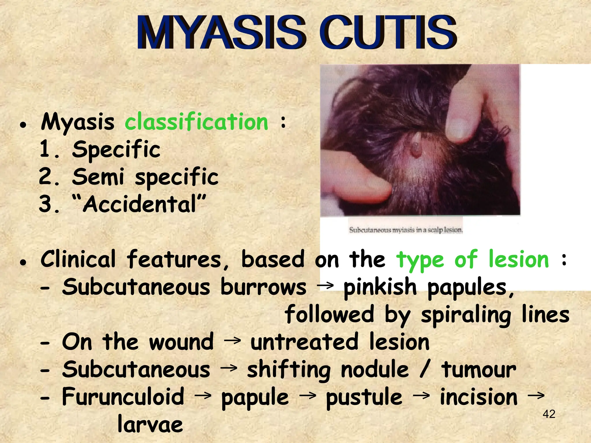 42
● Myasis classification :
1. Specific
2. Semi specific
3. “Accidental”
● Clinical features, based on the type of lesion :
- Subcutaneous burrows pinkish papules,
→
followed by spiraling lines
- On the wound untreated lesion
→
- Subcutaneous shifting nodule / tumour
→
- Furunculoid papule pustule incision
→ → → →
larvae
 