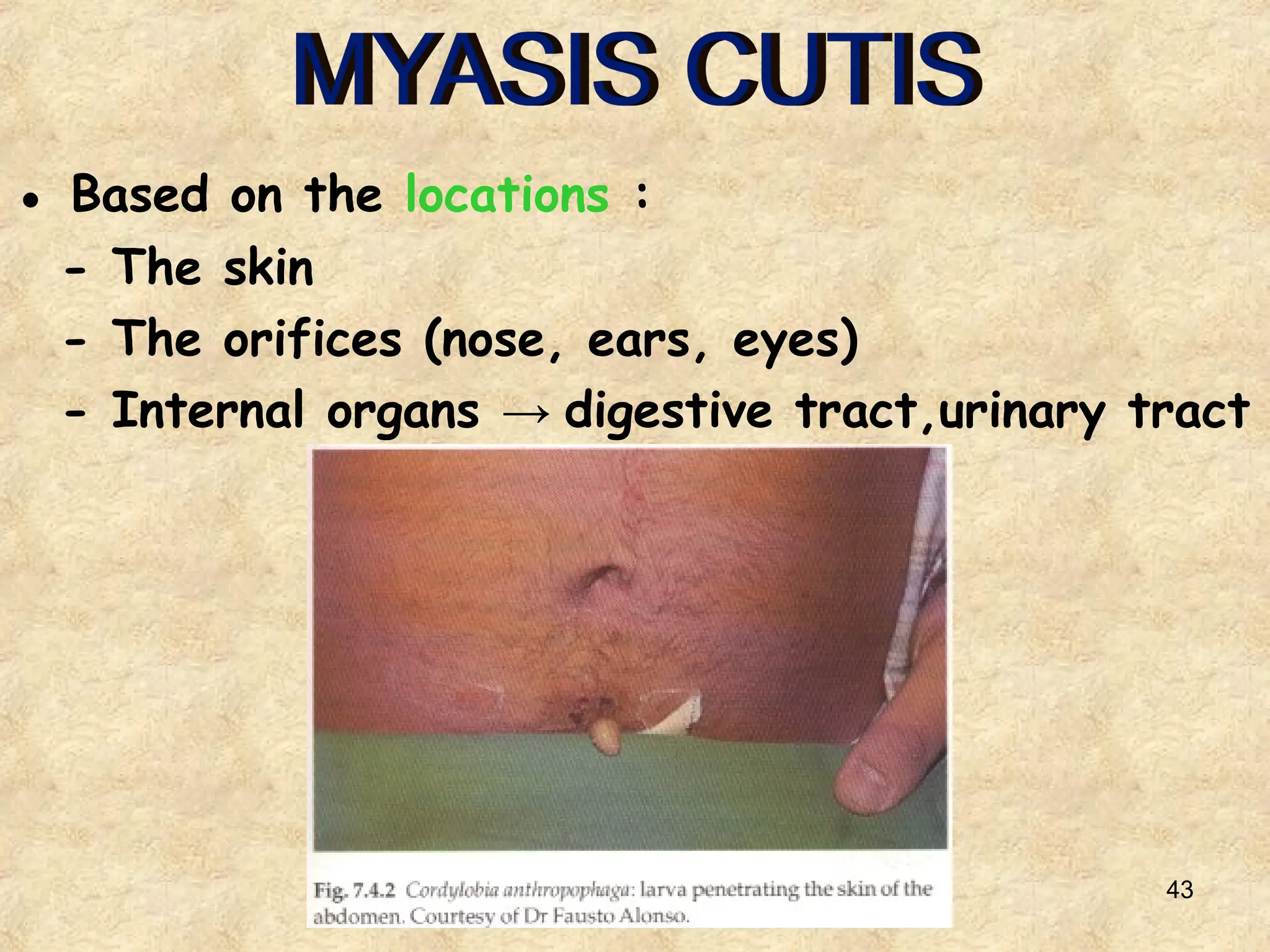 43
● Based on the locations :
- The skin
- The orifices (nose, ears, eyes)
- Internal organs → digestive tract,urinary tract
 