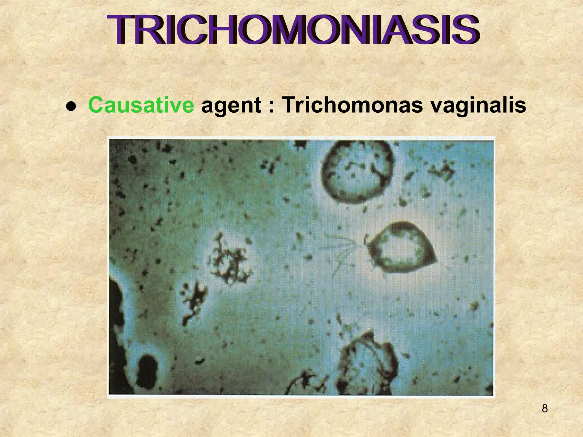8
● Causative agent : Trichomonas vaginalis
 