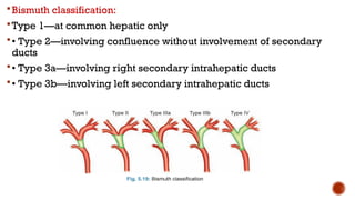 Bismuth classification:
Type 1—at common hepatic only
• Type 2—involving confluence without involvement of secondary
ducts
• Type 3a—involving right secondary intrahepatic ducts
• Type 3b—involving left secondary intrahepatic ducts
 