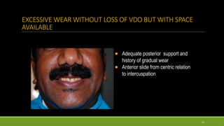 13. FULL MOUTH REHABILITATION in severly attrited dentition | PPTX