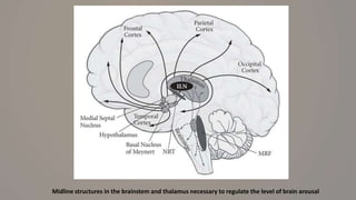 Midline structures in the brainstem and thalamus necessary to regulate the level of brain arousal
 