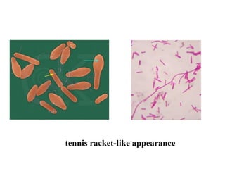 tennis racket-like appearance
 