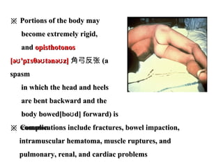※※ Portions of the body mayPortions of the body may
become extremely rigid,become extremely rigid,
andand opisthotonosopisthotonos
[ə 'p sθə tənə z]ʊ ɪ ʊ ʊ[ə 'p sθə tənə z]ʊ ɪ ʊ ʊ 角弓反张 (a(a
spasmspasm
in which the head and heelsin which the head and heels
are bent backward and theare bent backward and the
body bowed[bo d] forward) isʊbody bowed[bo d] forward) isʊ
common.common.※※ Complications include fractures, bowel impaction,Complications include fractures, bowel impaction,
intramuscular hematoma, muscle ruptures, andintramuscular hematoma, muscle ruptures, and
pulmonary, renal, and cardiac problemspulmonary, renal, and cardiac problems
 
