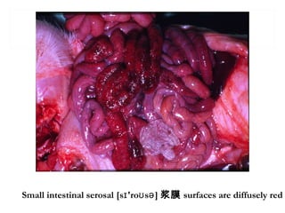 Small intestinal serosal [s 'ro s ]ɪ ʊ ə 浆膜 surfaces are diffusely red
 